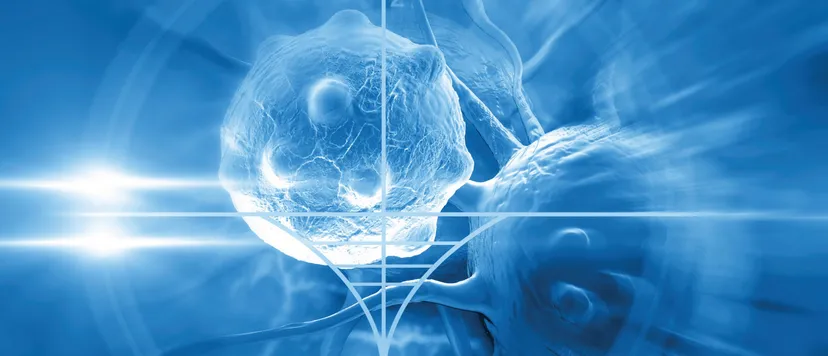 Illustration of tumor cells